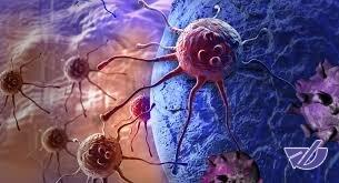  مهم‌ترین عوامل ابتلا به سرطان پستان!